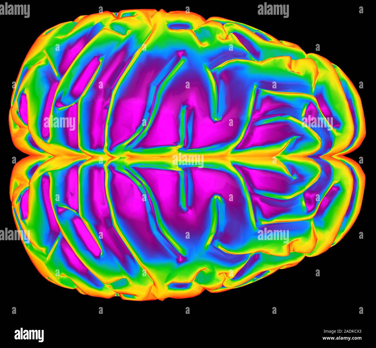 Brain. Computer artwork of a human brain (top view). The front of the ...