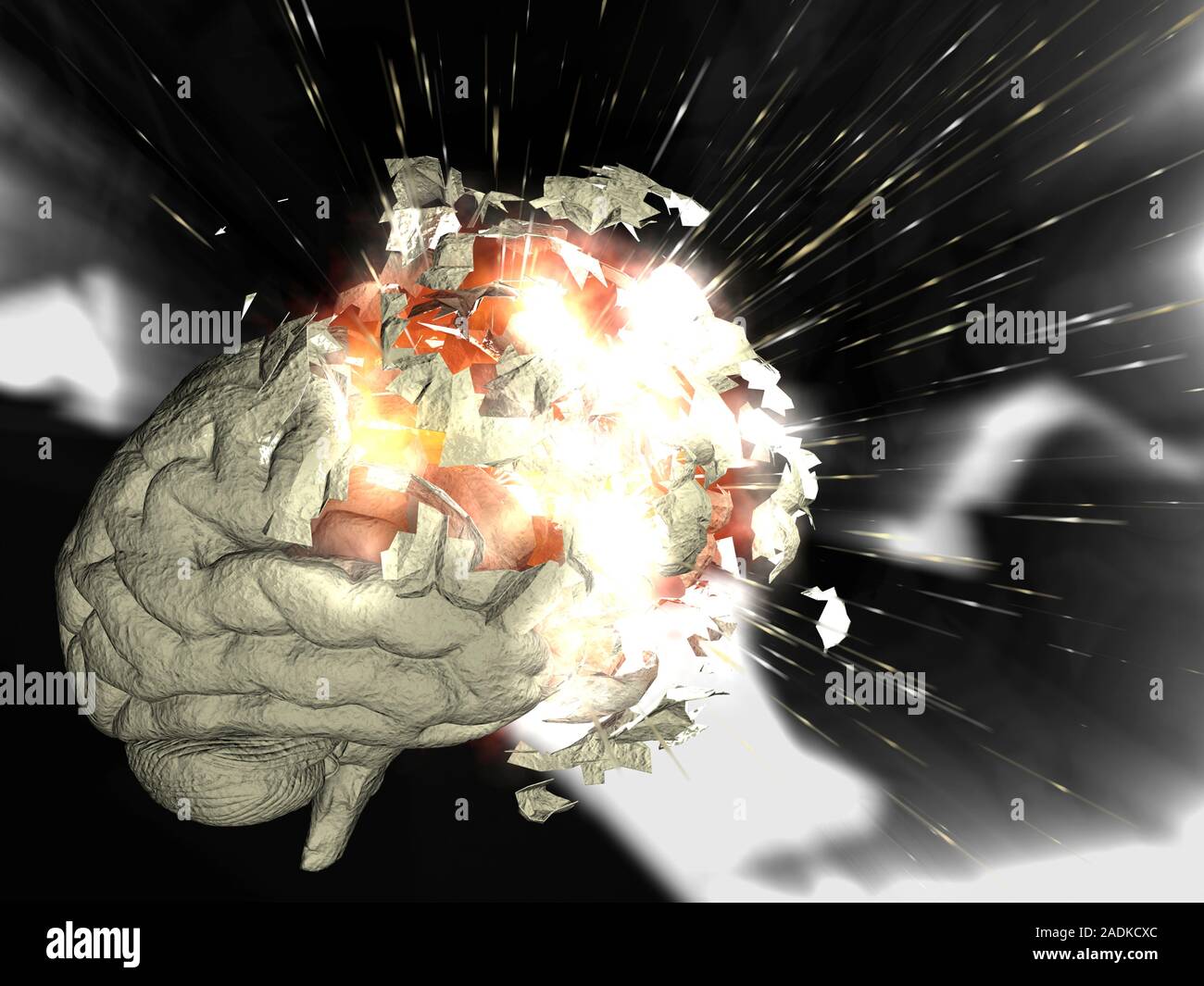 Exploding brain. Conceptual computer artwork of a human brain exploding. This image could represent mental stress or complex thought processes leading Stock Photo