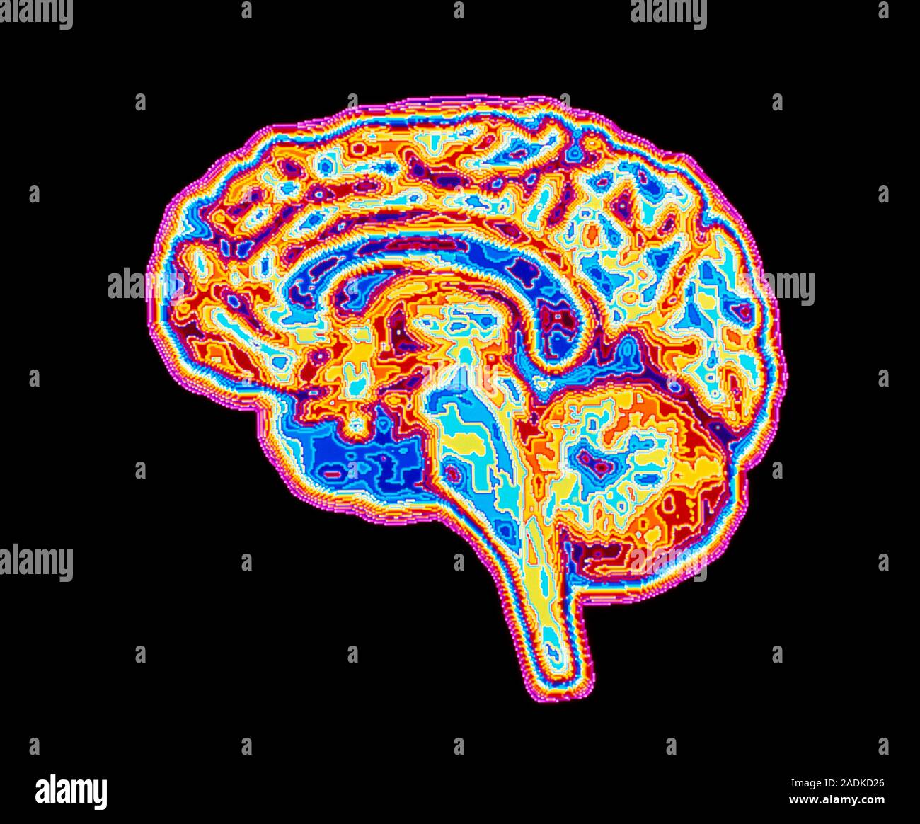 False-colour computer graphics image of a sagittal section through the ...
