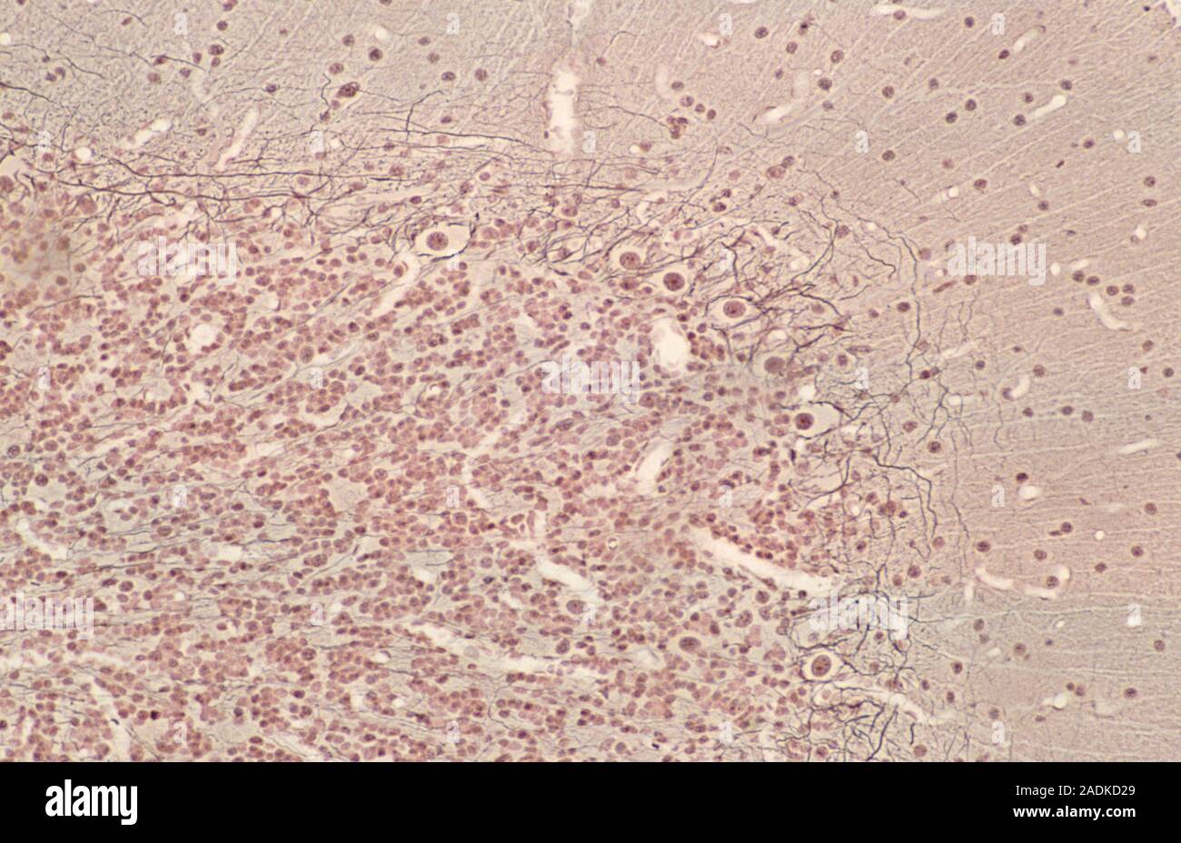 Light micrograph of a section of normal human cerebellum. The cortex of ...