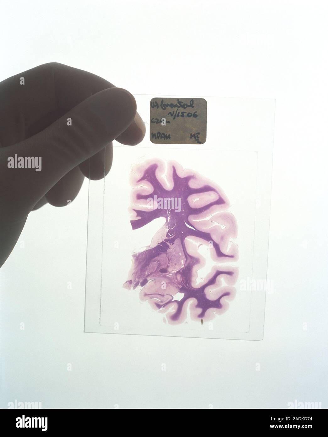 Brain slice. Gloved hand holding up a microscope slide of a section ...