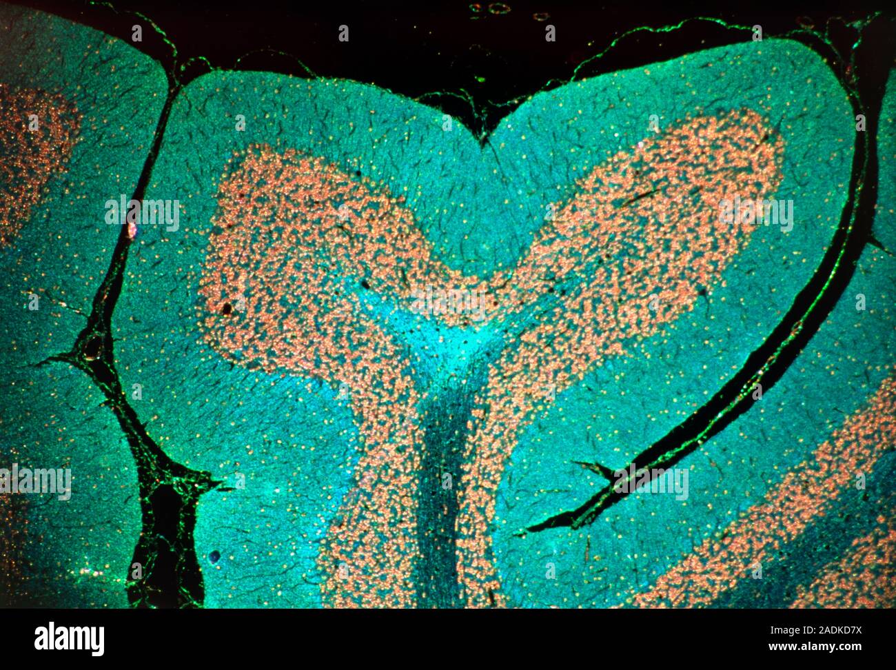 Brain tissue. Light micrograph of a section through the cerebellum of ...