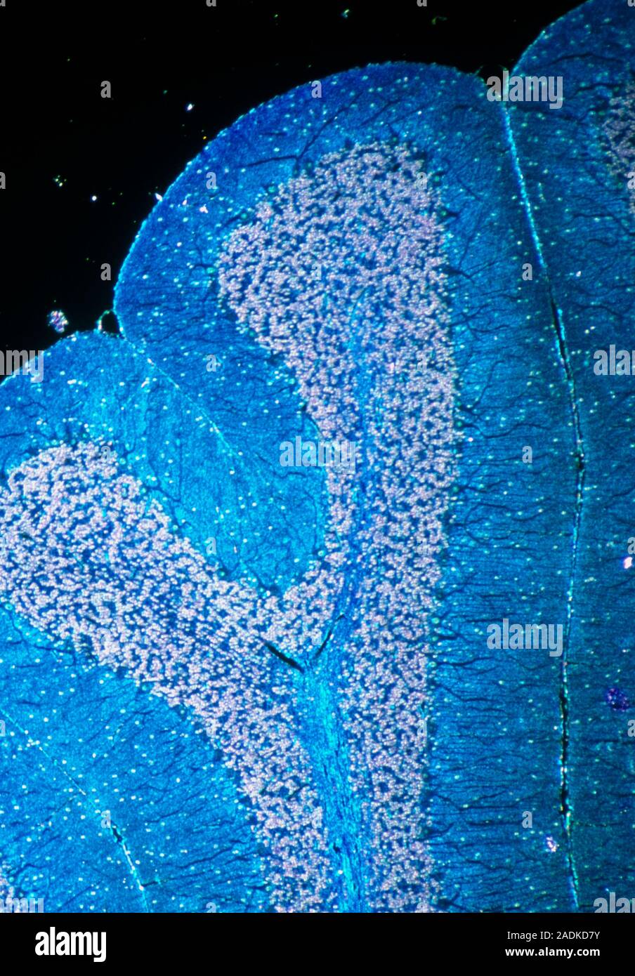 Brain tissue. Light micrograph of a section through the cerebellum of ...