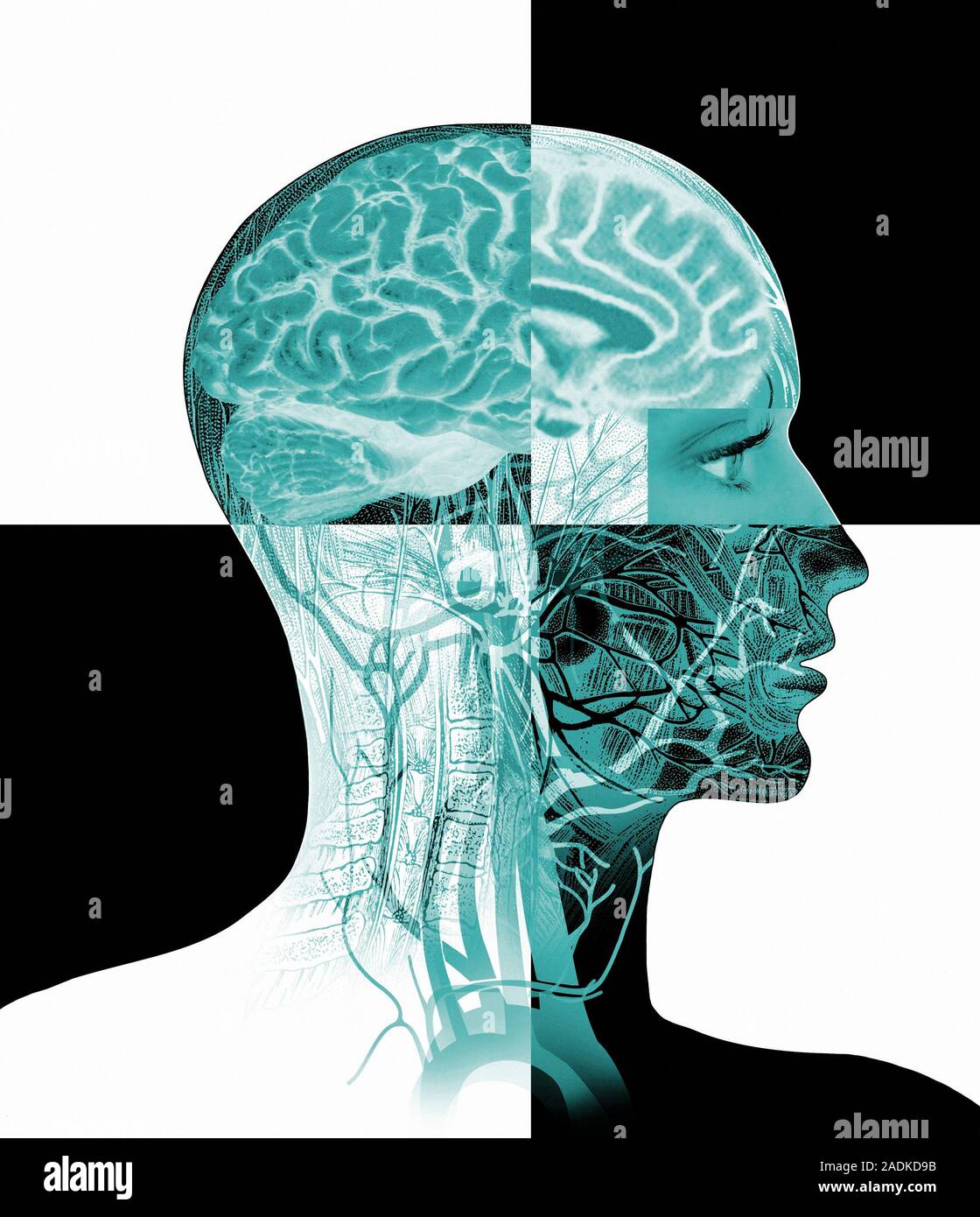 Brain anatomy. Artwork combining profiles of brain and head anatomy