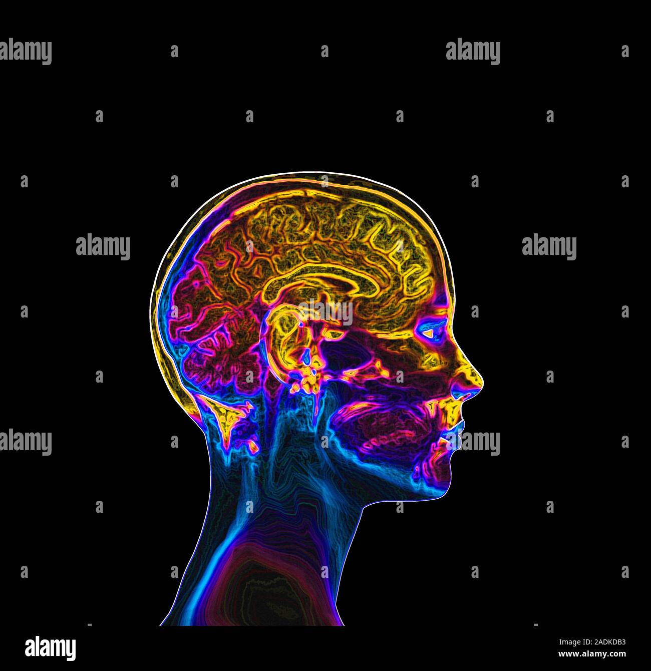 Brain. Computer artwork of a side view of a healthy human brain and ...