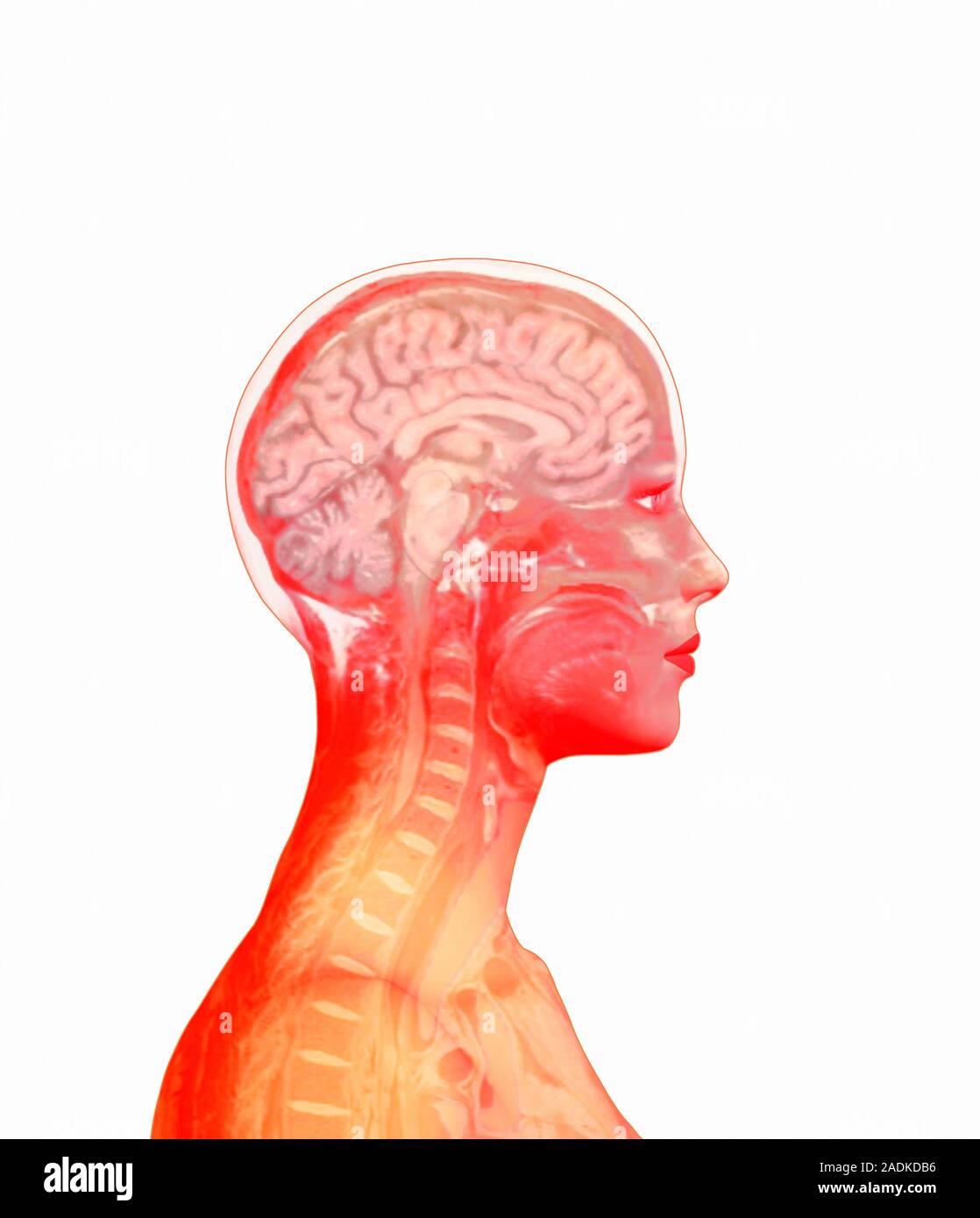 Brain. Computer artwork of a side view of a healthy human brain. At ...