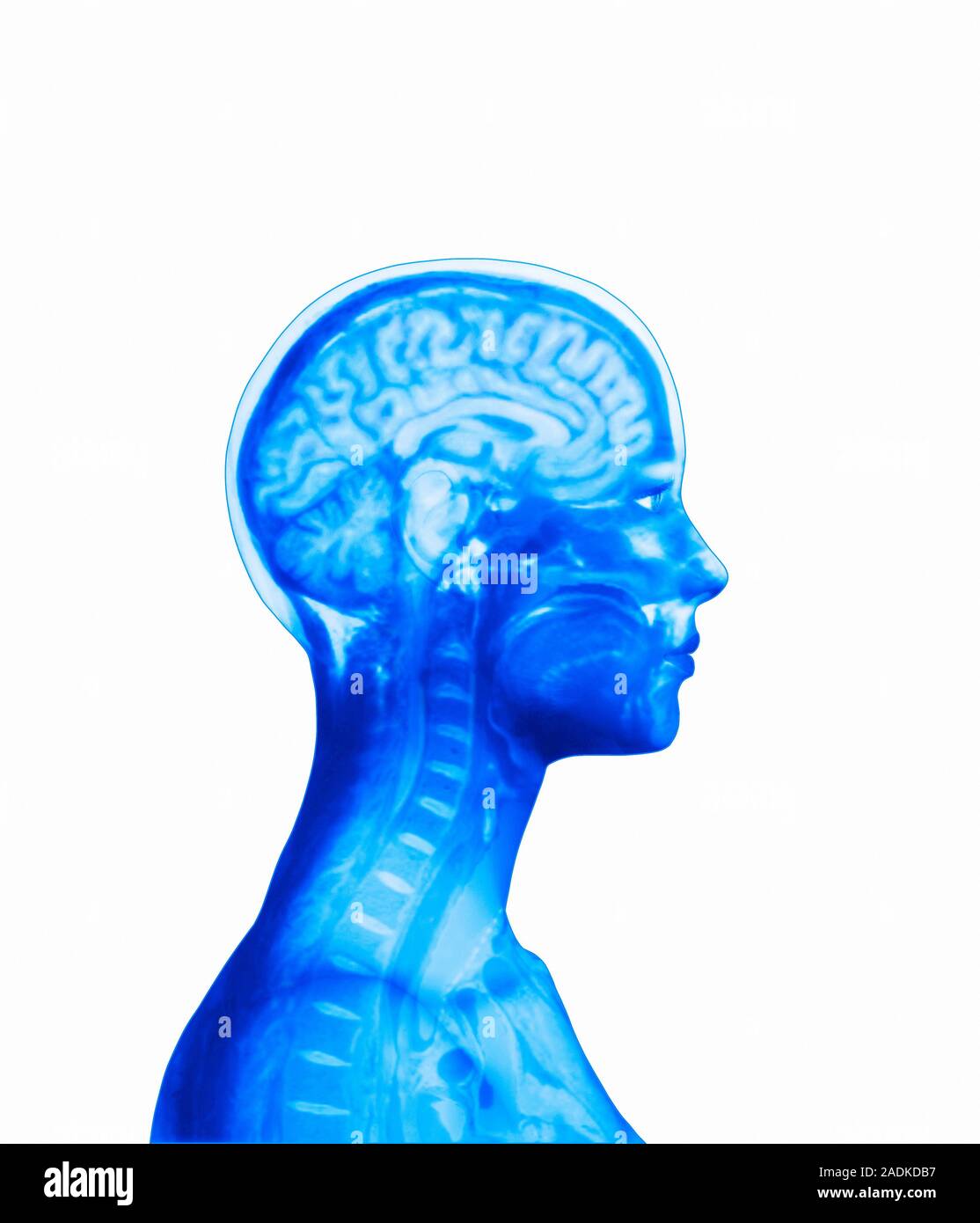 Brain. Computer artwork of a side view of a healthy human brain. At ...