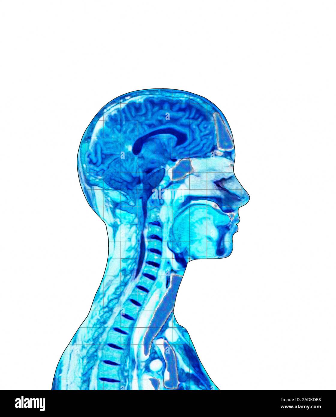 Brain. Computer artwork of a side view of a healthy human brain. At ...