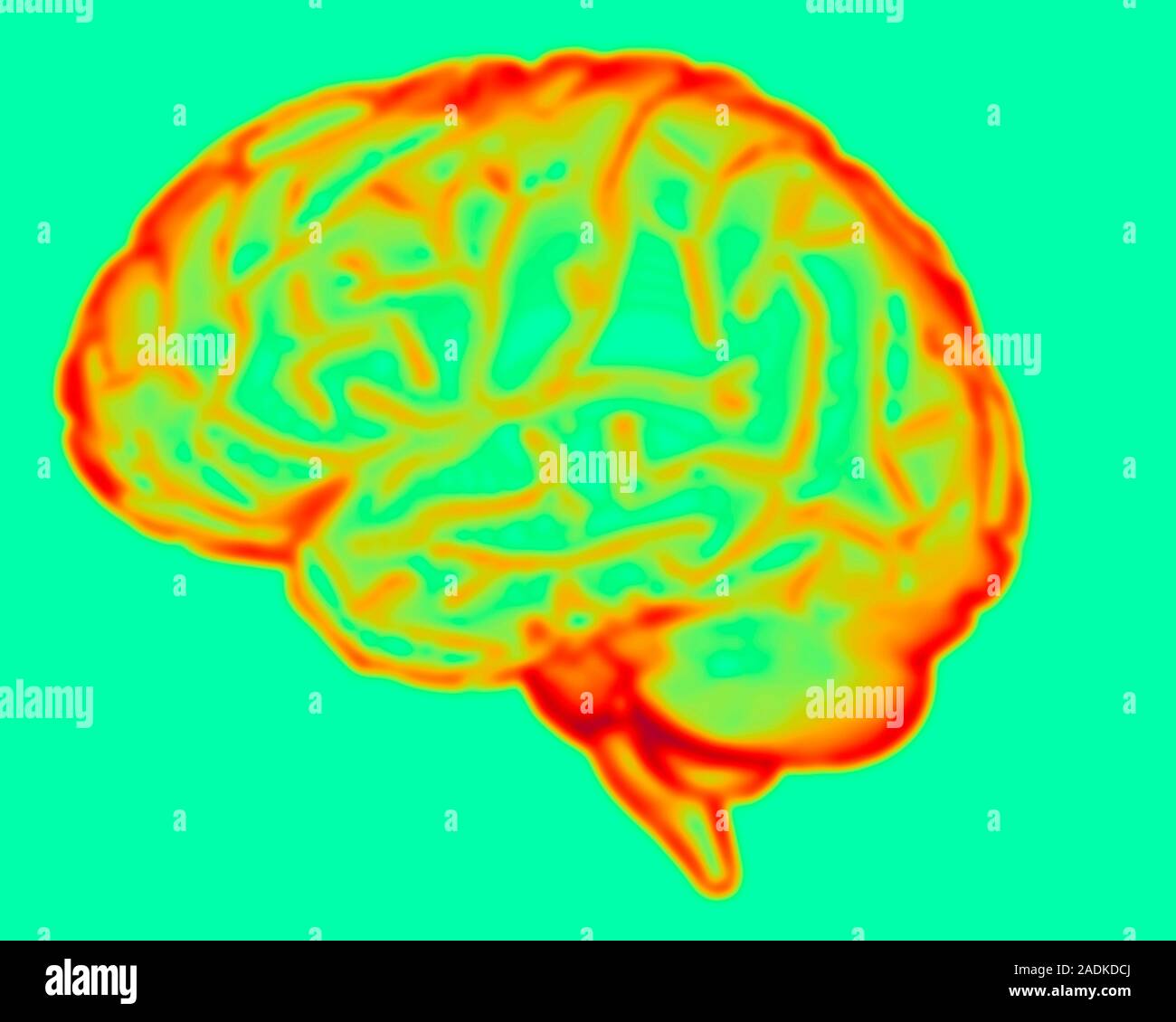Brain. Computer artwork of a side view of a healthy human brain. The ...
