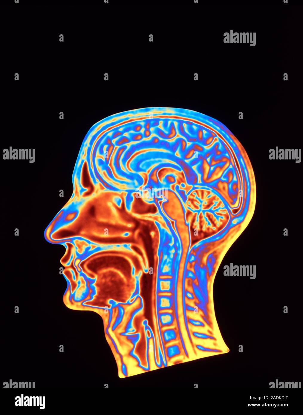 Scan through. Микро xperts цена. Scan through. Ct scan abdominal axial plane label. Proglove mark 2 wearables.