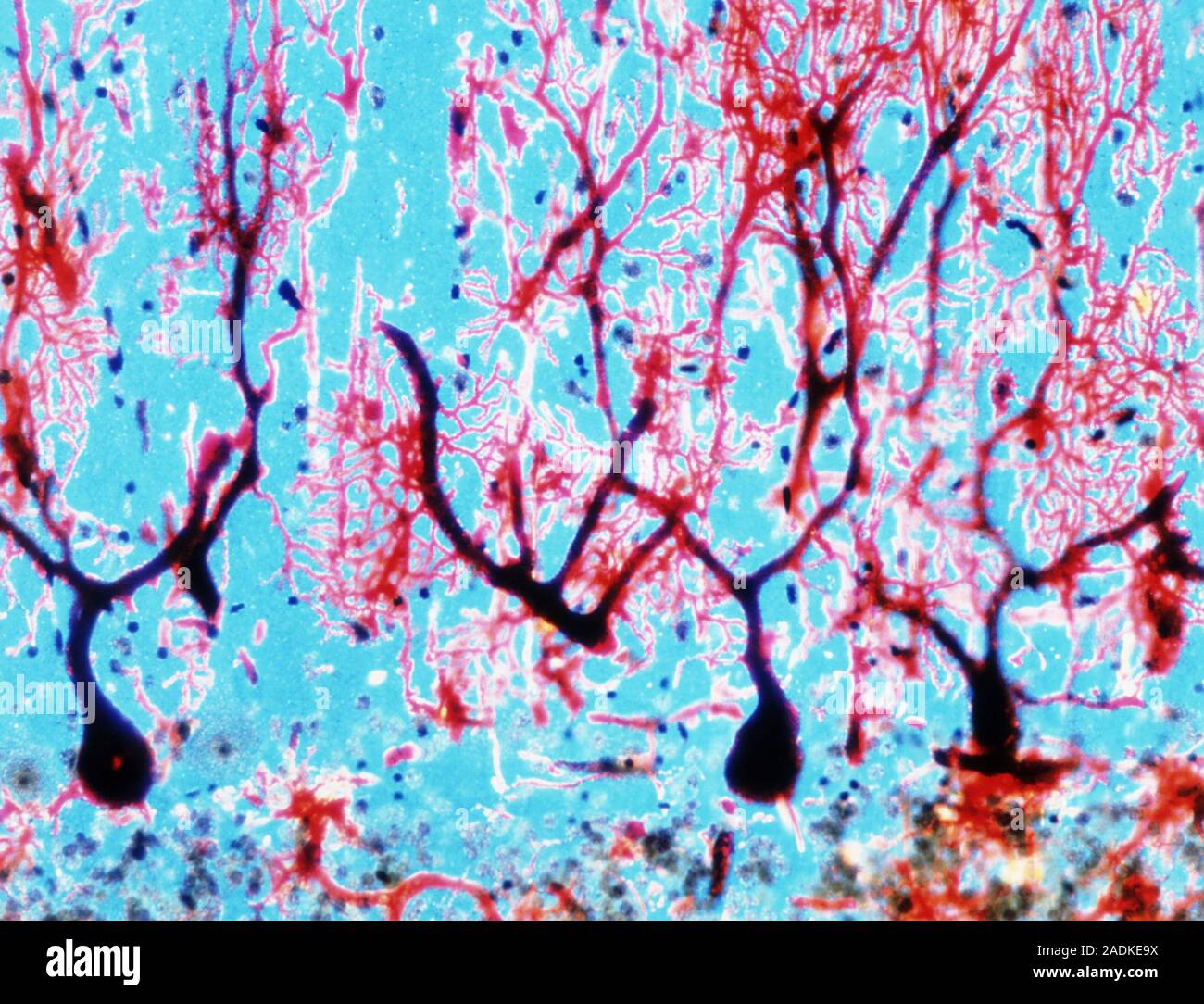 Purkinje nerve cells. Light micrograph of a cross section of cerebellar ...