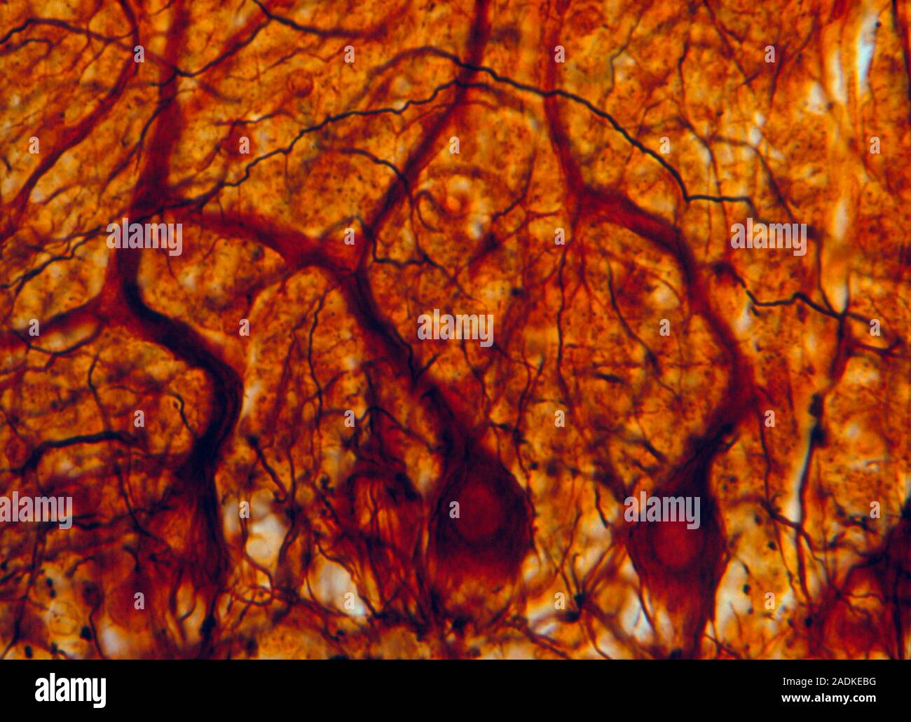 Purkinje nerve cells. Light micrograph of a row of Purkinje nerve cells ...