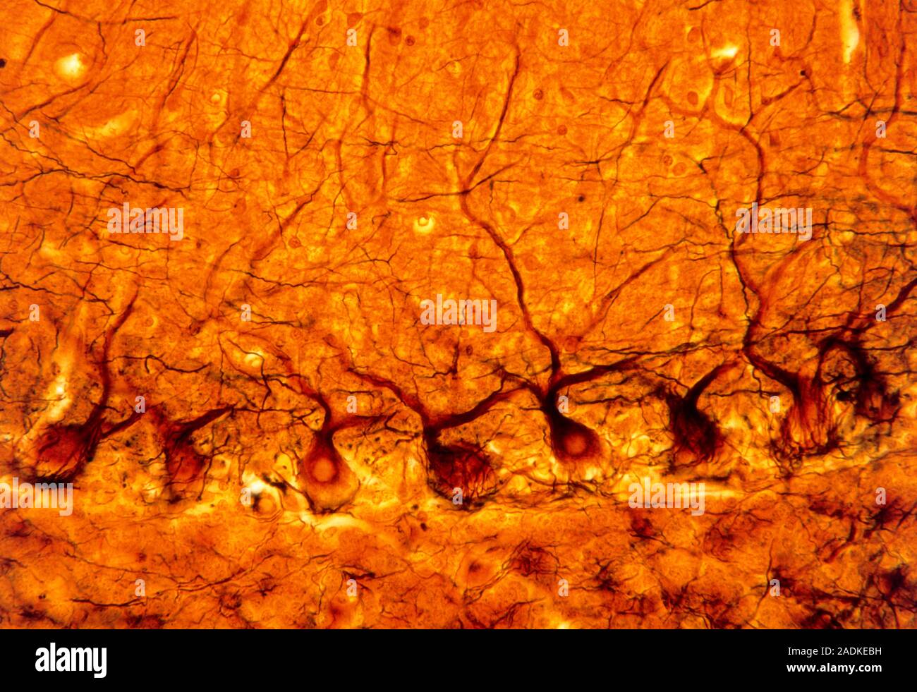Purkinje nerve cells. Light micrograph of a row of Purkinje nerve cells ...