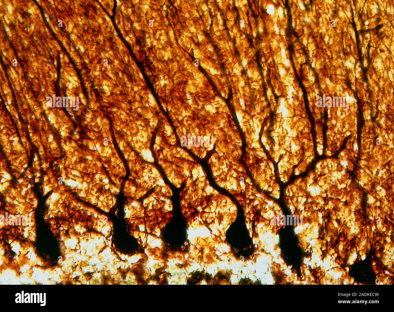 Purkinje nerve cells. Light micrograph of a section through a row of ...