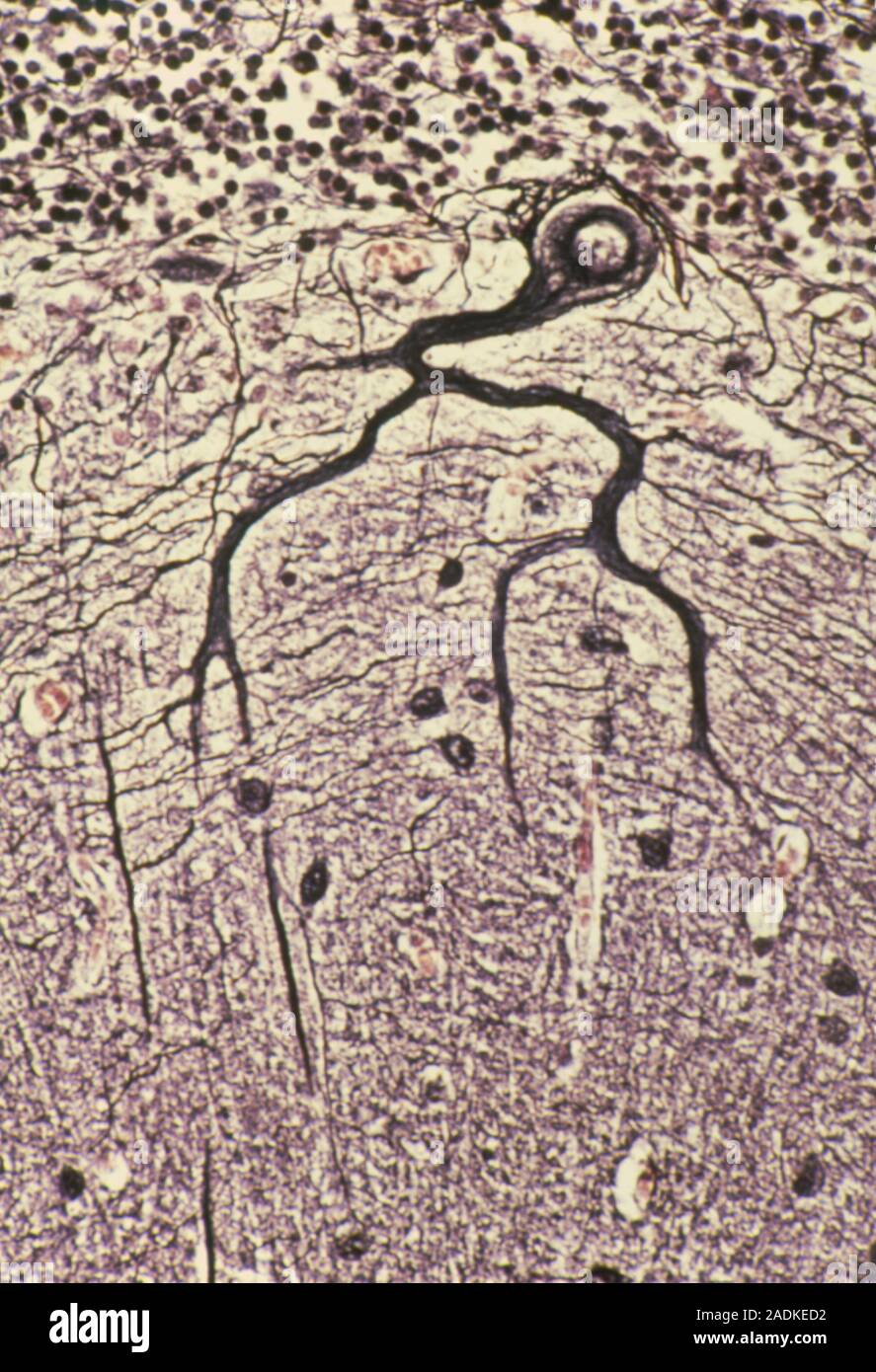 Purkinje nerve cell. Light micrograph of a section through a Purkinje ...