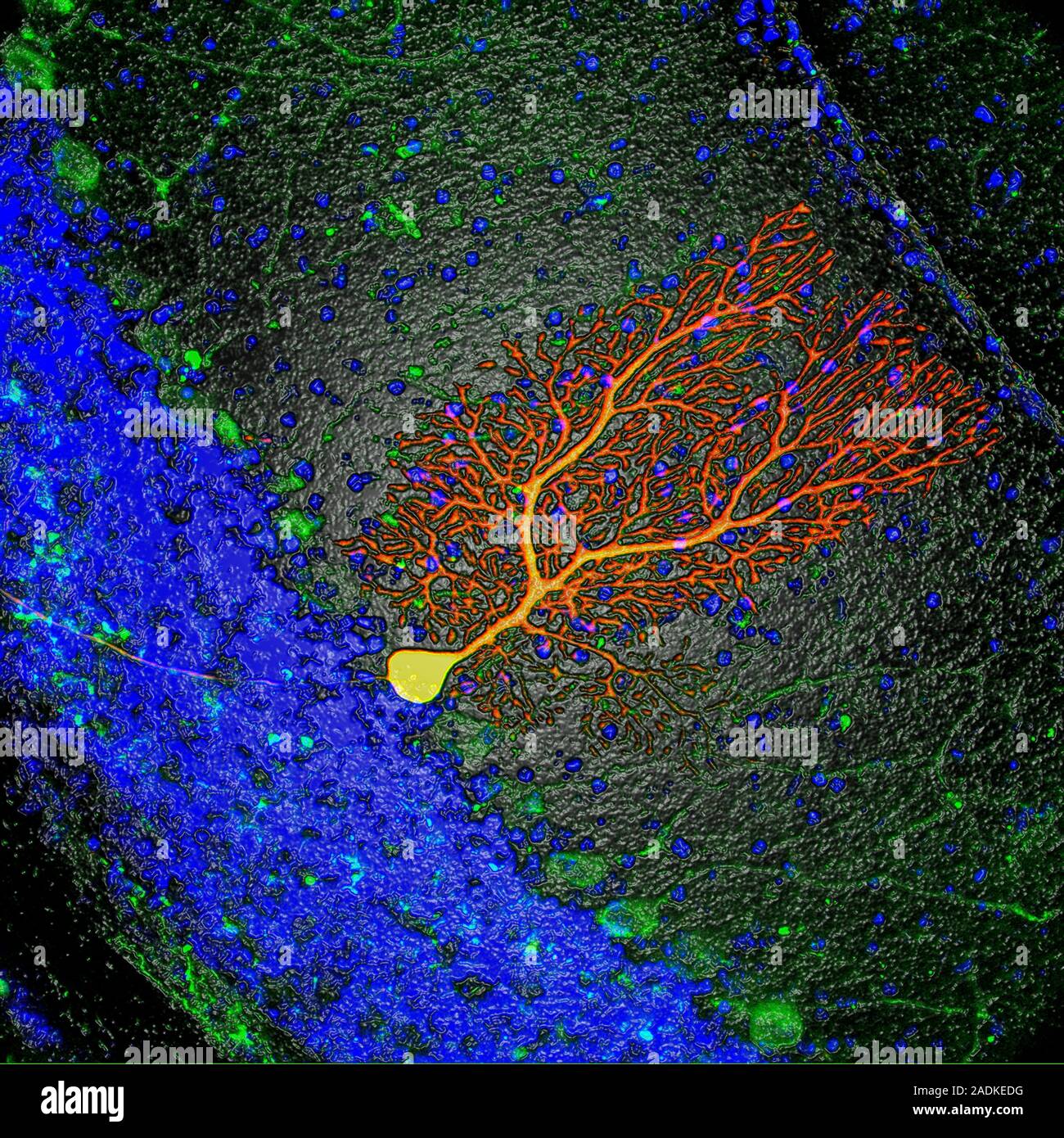 Purkinje nerve cell. Computer-enhanced confocal light micrograph of a ...