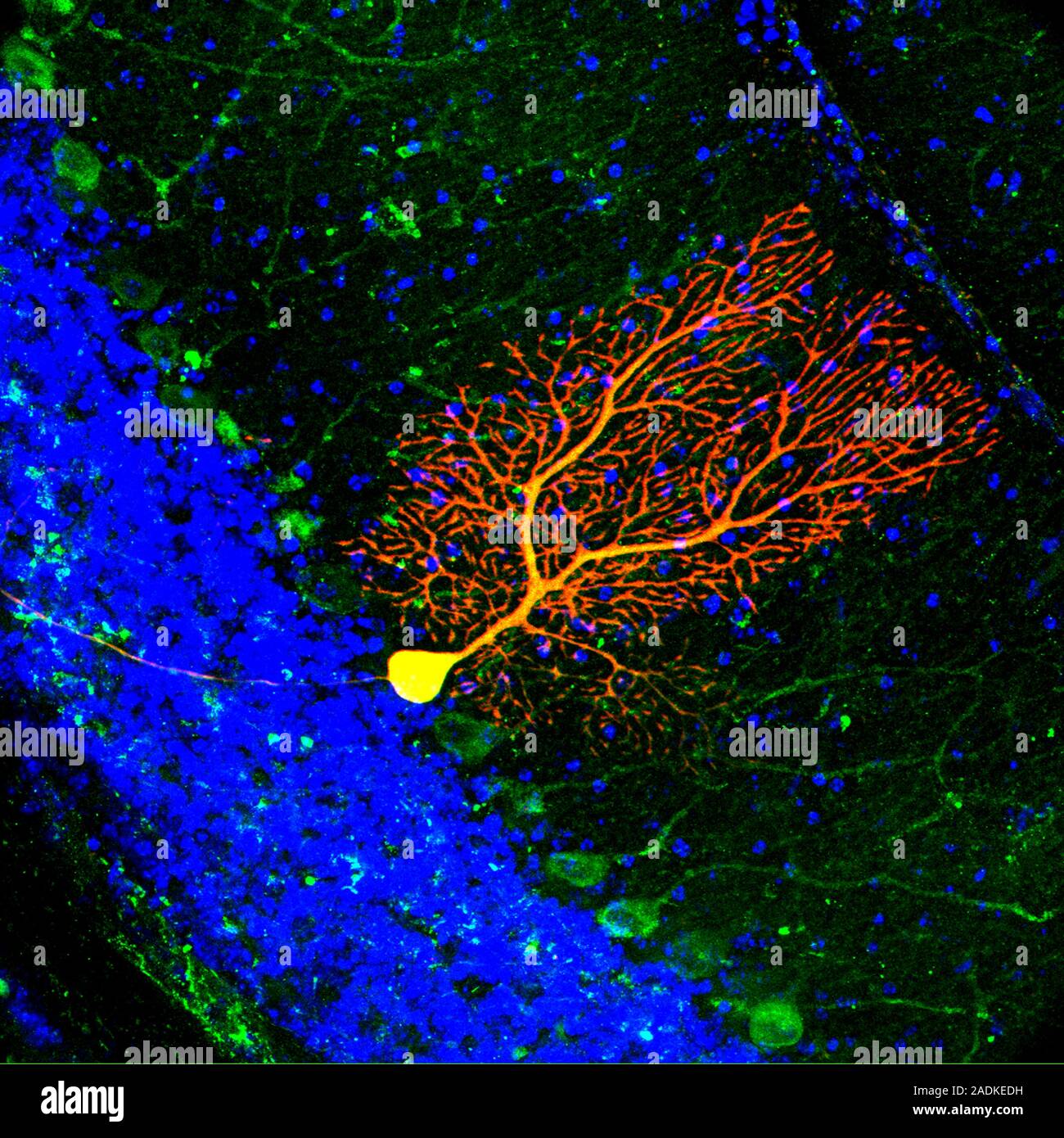 Purkinje nerve cell. Coloured confocal light micrograph of a section ...
