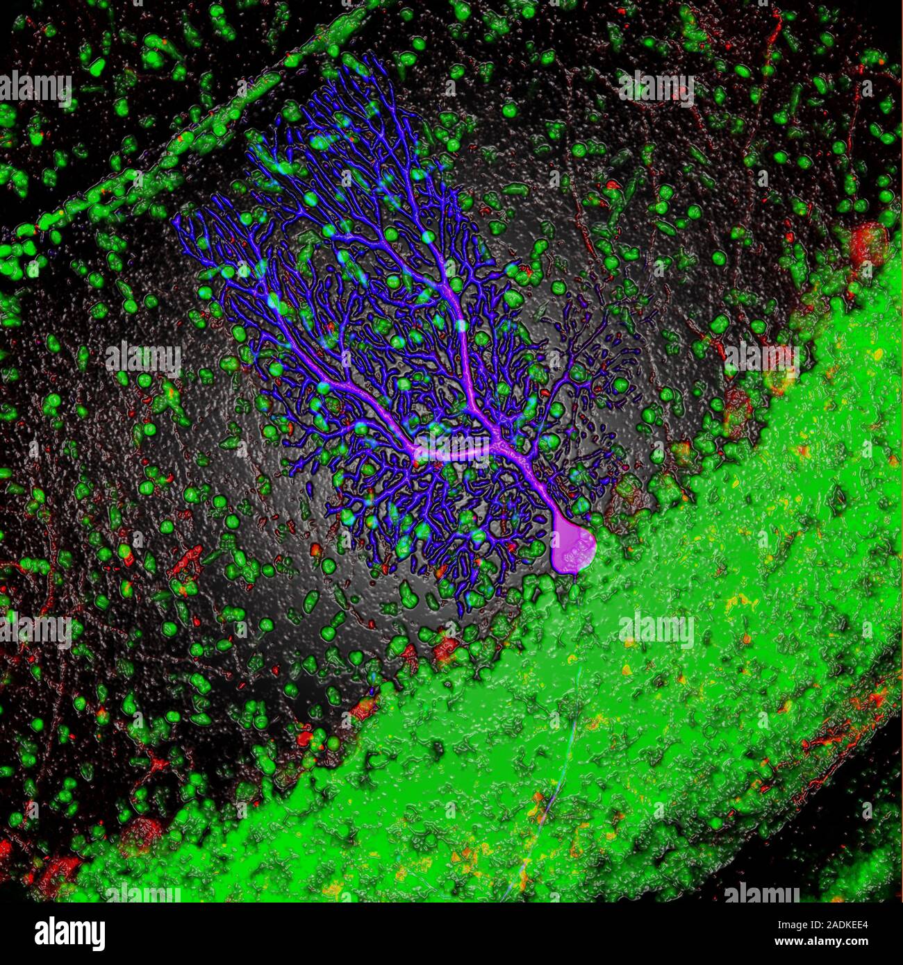 Purkinje nerve cell. Computer-enhanced confocal light micrograph of a ...