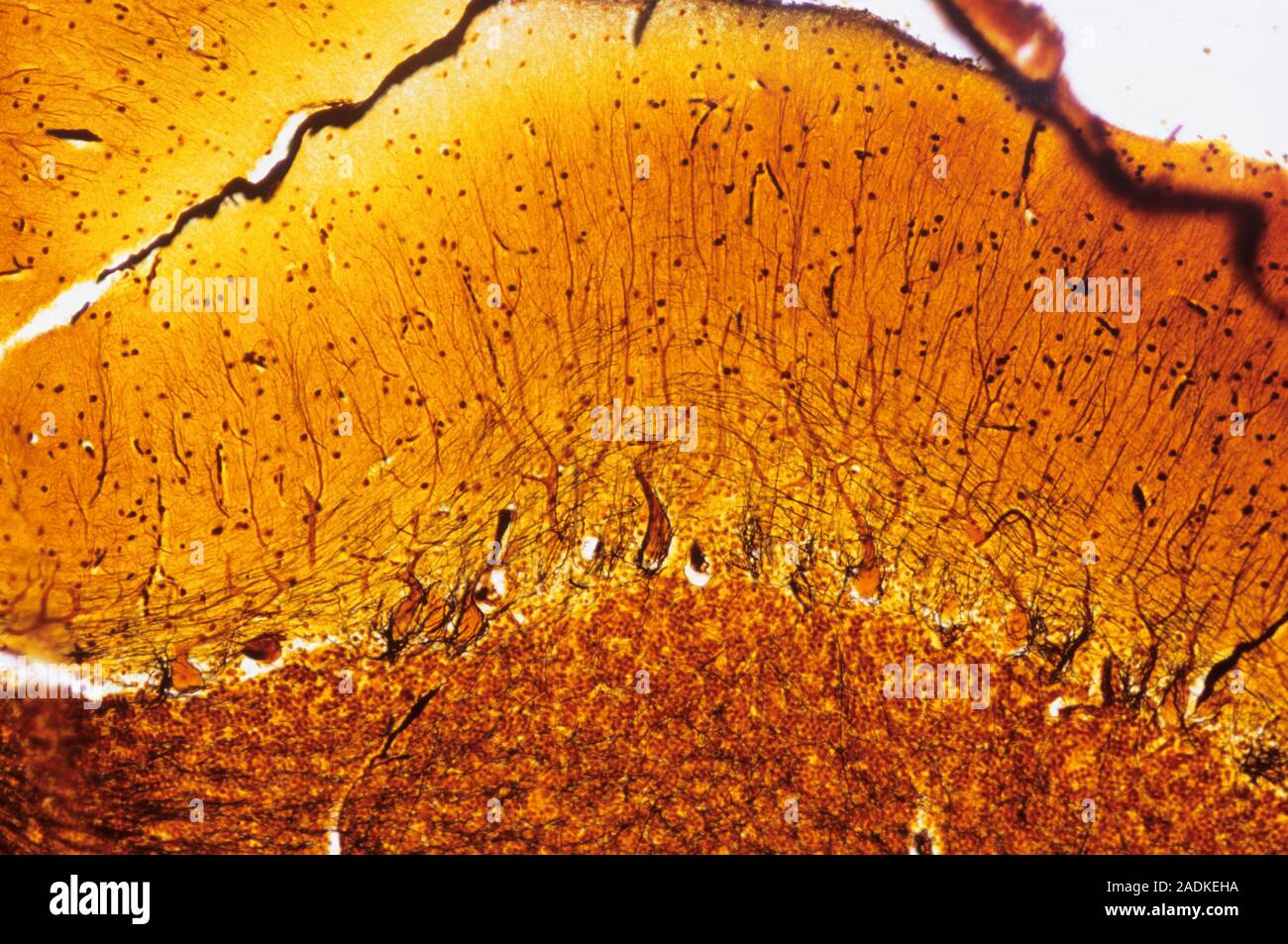 Purkinje nerve cells. Light micrograph of a section through a row of ...