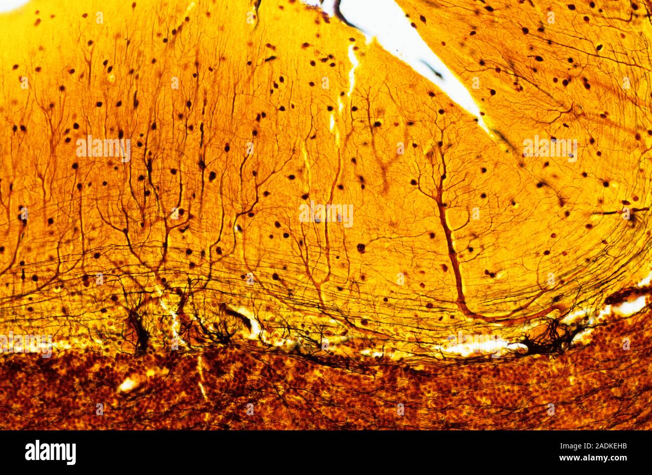Purkinje nerve cells. Light micrograph of a section through a row of ...