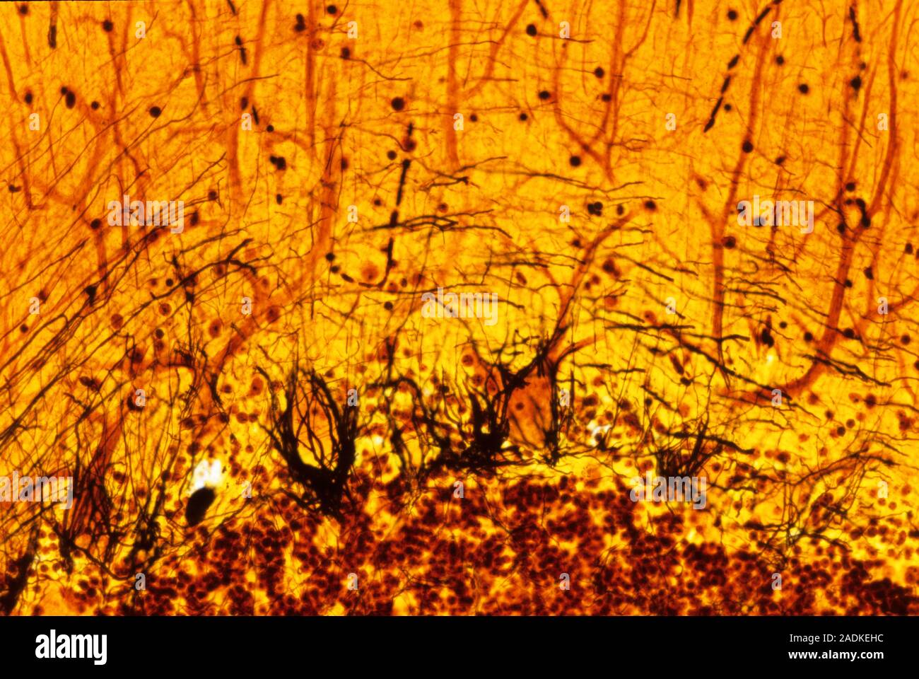 Purkinje nerve cells. Light micrograph of a section through a row of ...