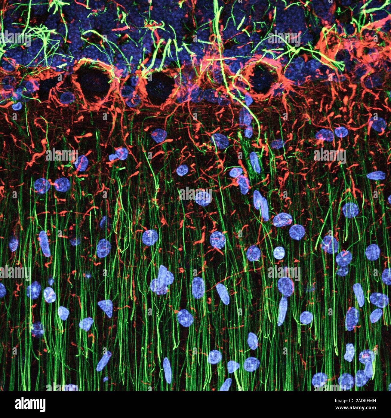 Cerebellum tissue. Confocal light micrograph of a section through the ...
