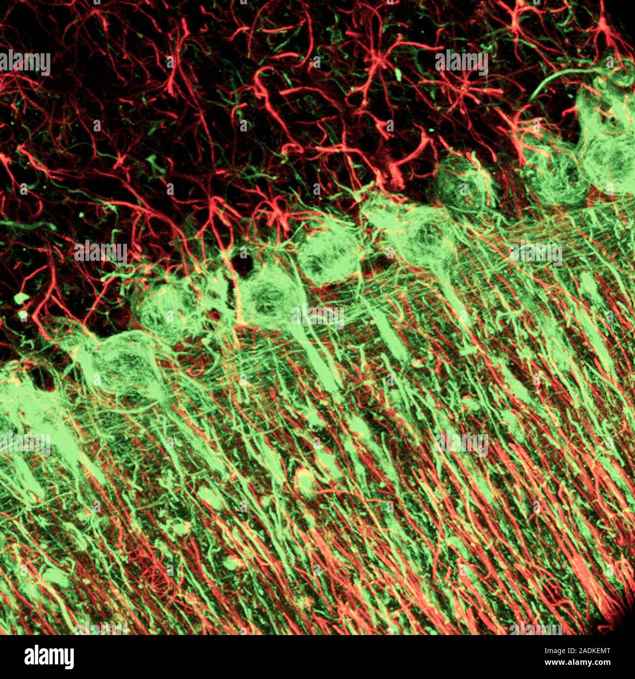 Cerebellum tissue. Confocal light micrograph of a section through the ...