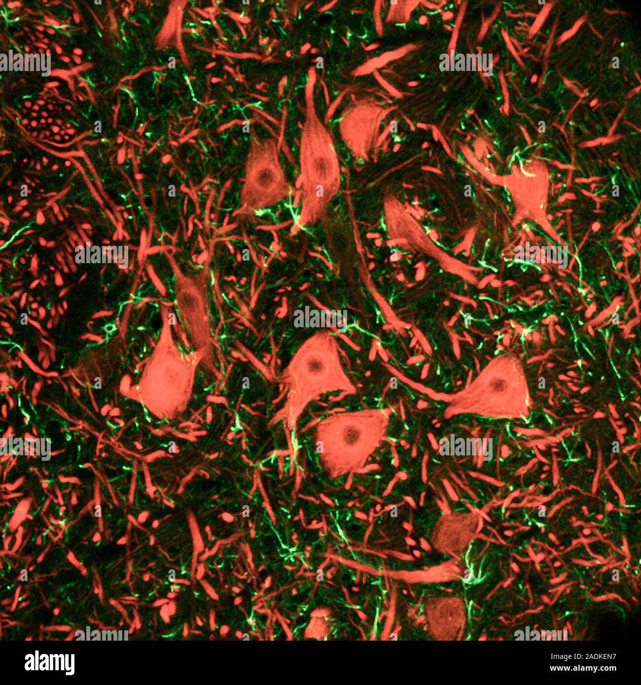 Brainstem nerve cells. Confocal light micrograph of neurons (nerve ...