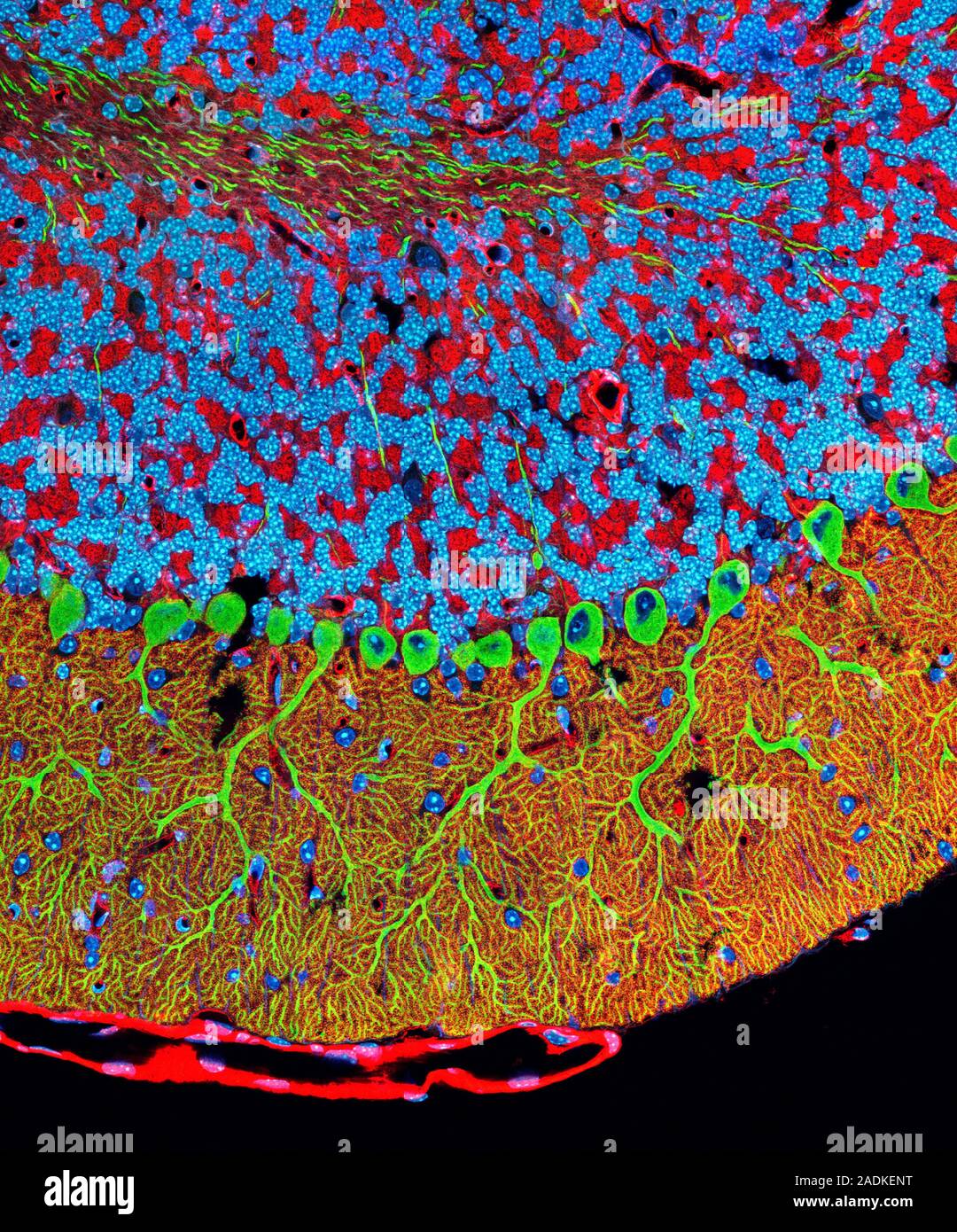 Purkinje cells in the cerebellum. Fluorescent light micrograph of ...