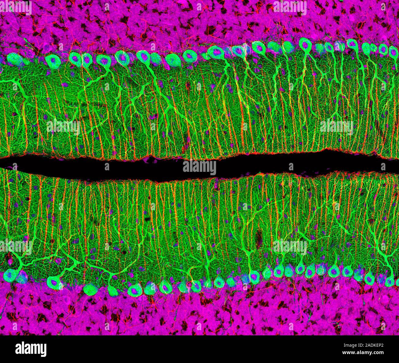Purkinje cells in the cerebellum. Fluorescent light micrograph of ...