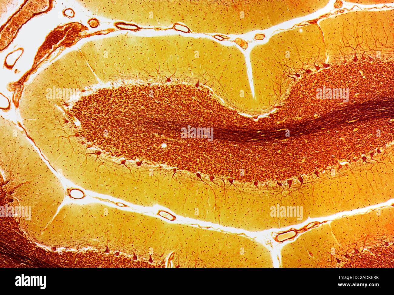 Purkinje nerve cells. Light micrograph of a section through the ...