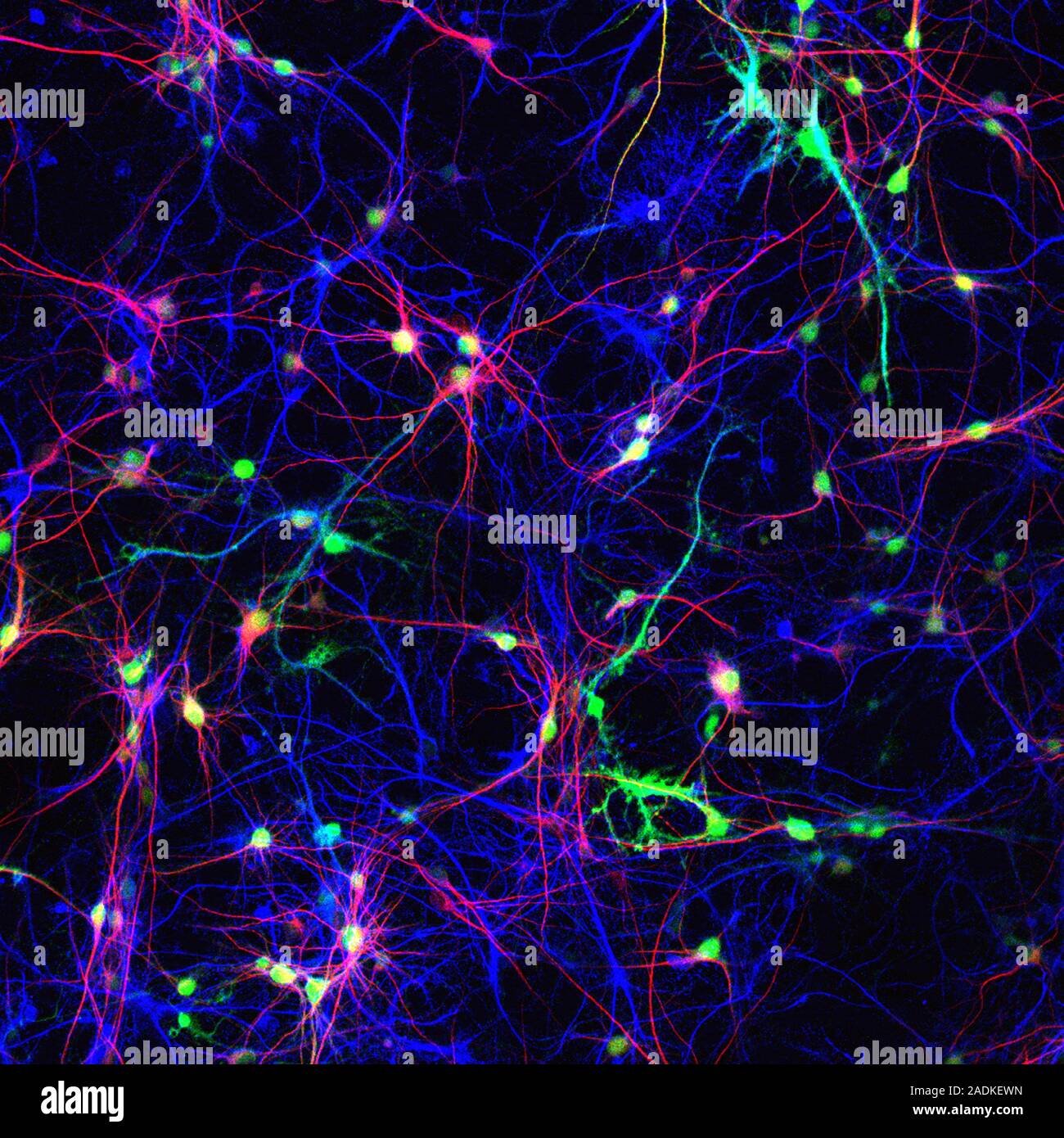 Brain nerve cells. Confocal light micrograph of a section through the ...