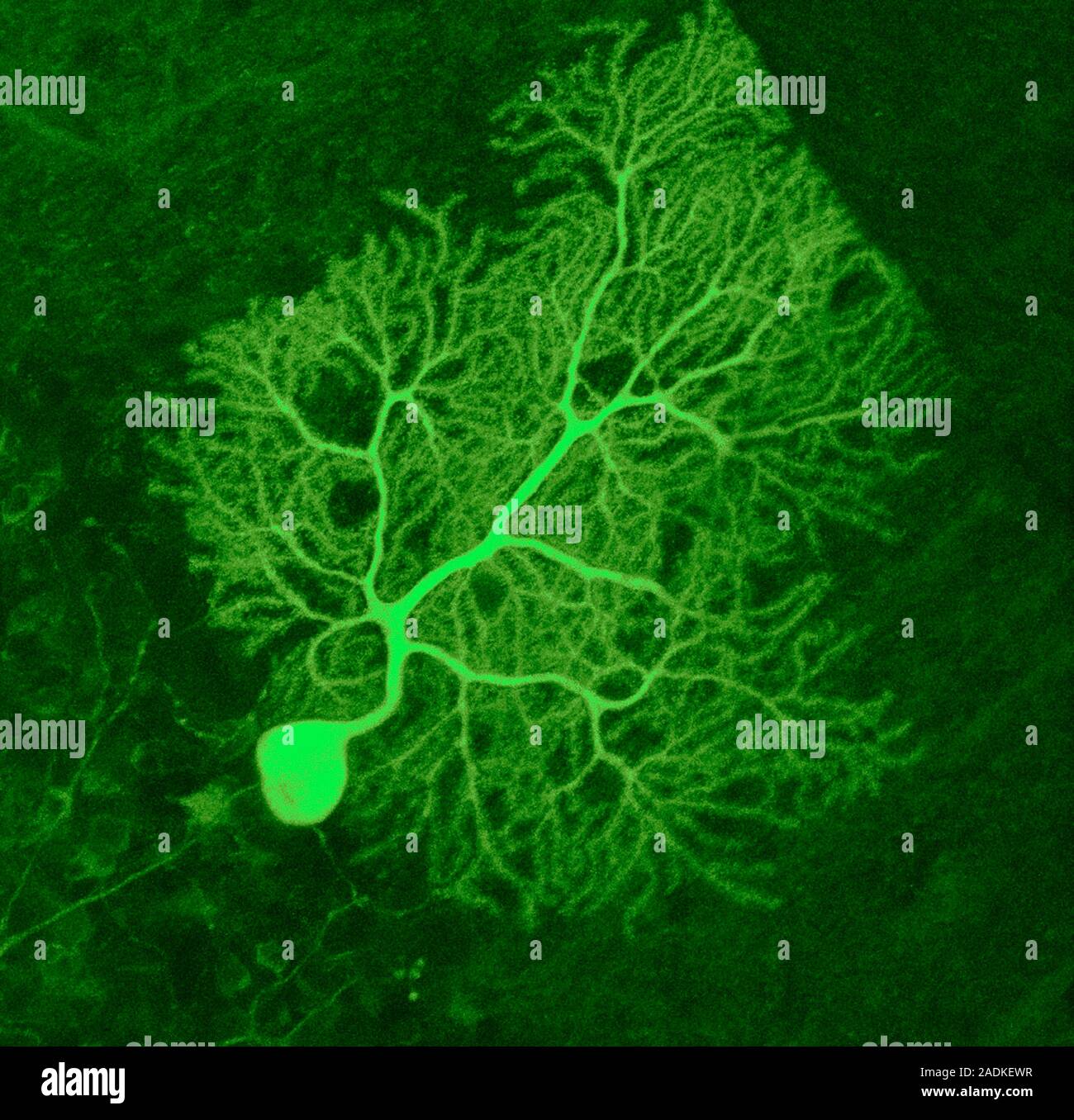 Purkinje nerve cell. Confocal light micrograph of a purkinje cell ...