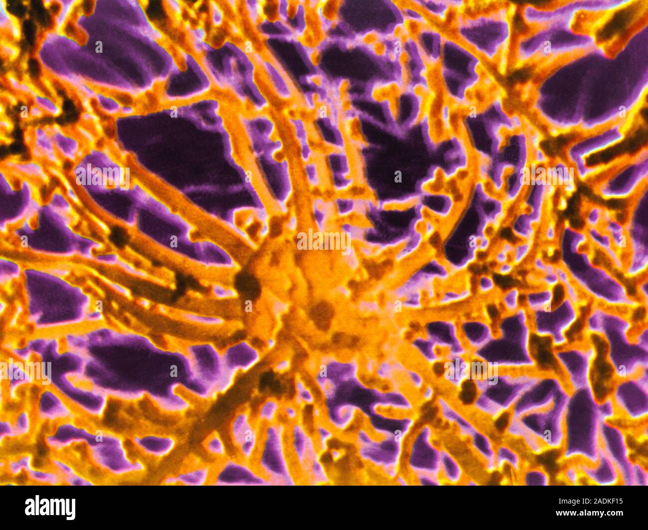 False-colour scanning electron micrograph (SEM) of the surface of the ...