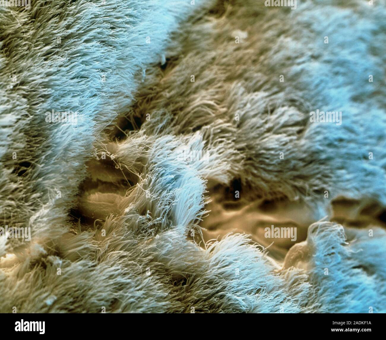 Nasal lining. Coloured scanning electron micrograph (SEM) of cilia ...