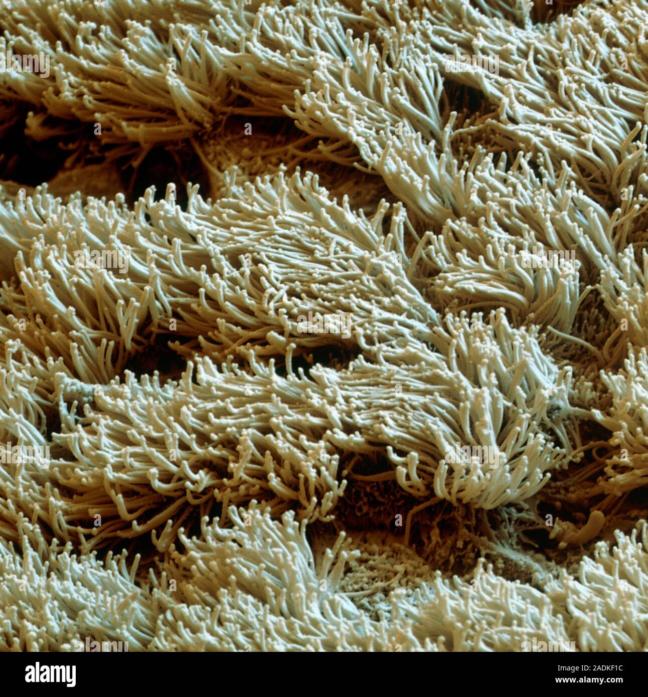 Nasal lining. Coloured scanning electron micrograph (SEM) of cilia ...