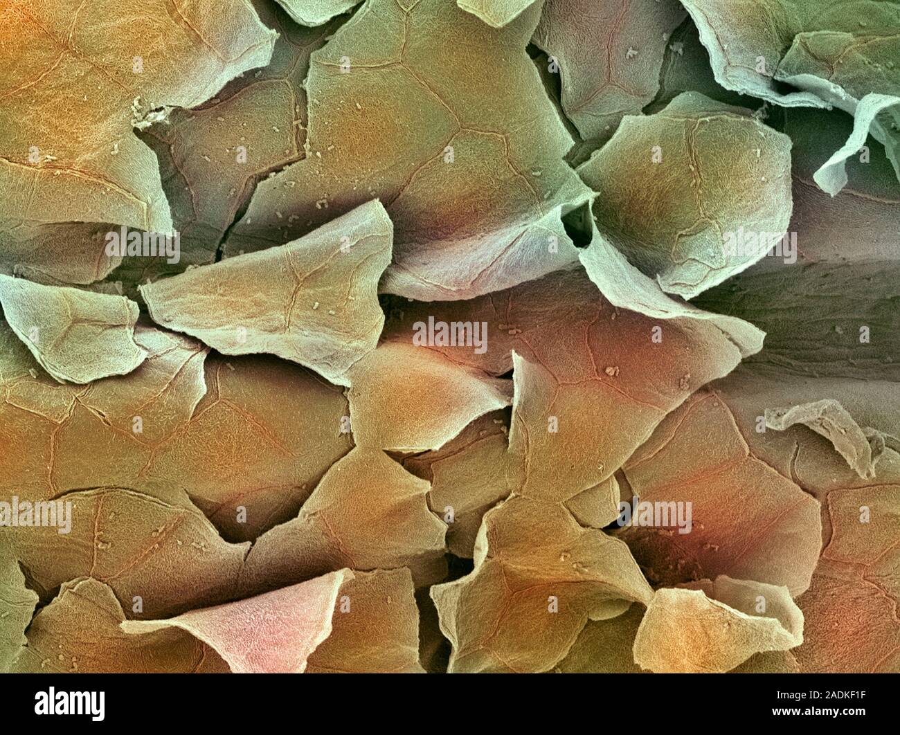 Nasal lining. Coloured scanning electron micrograph (SEM) of stratified ...