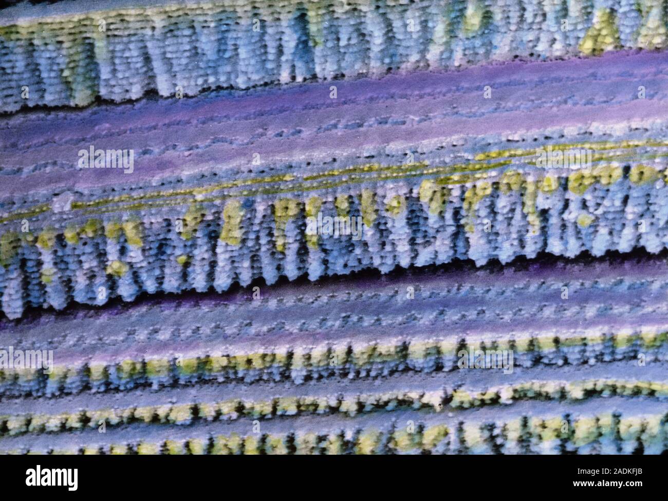Lens of the eye. False-colour scanning electron micrograph (SEM) of ...