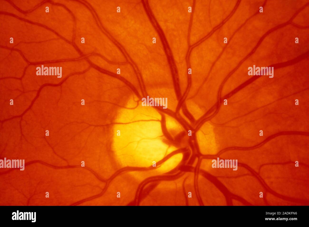 Healthy retina. Fundus camera (ophthalmoscope) image of the retina of a