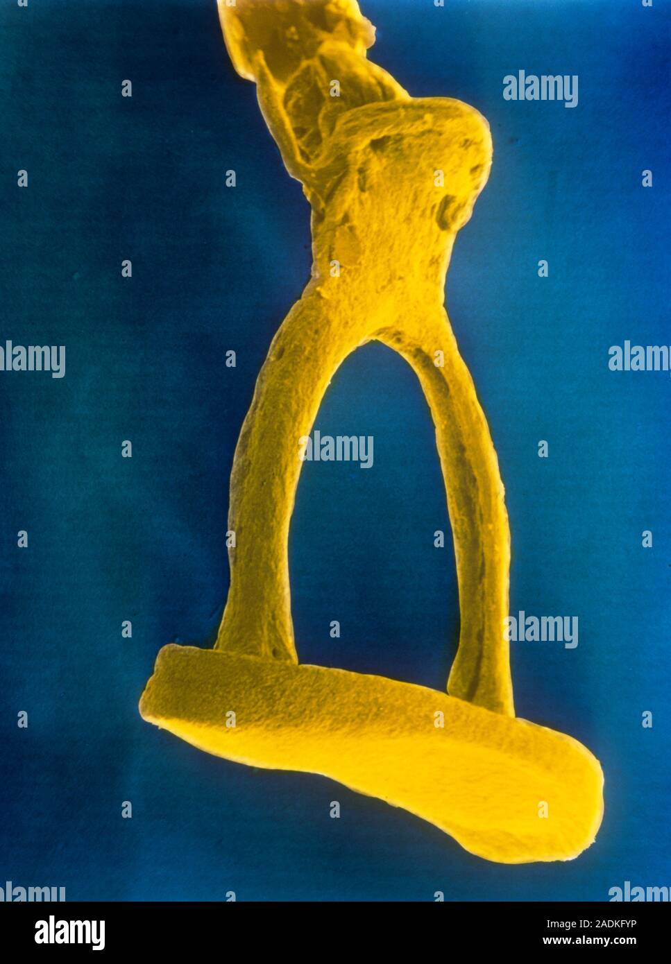 Falsecolour scanning electron micrograph (SEM) of the stapes, the