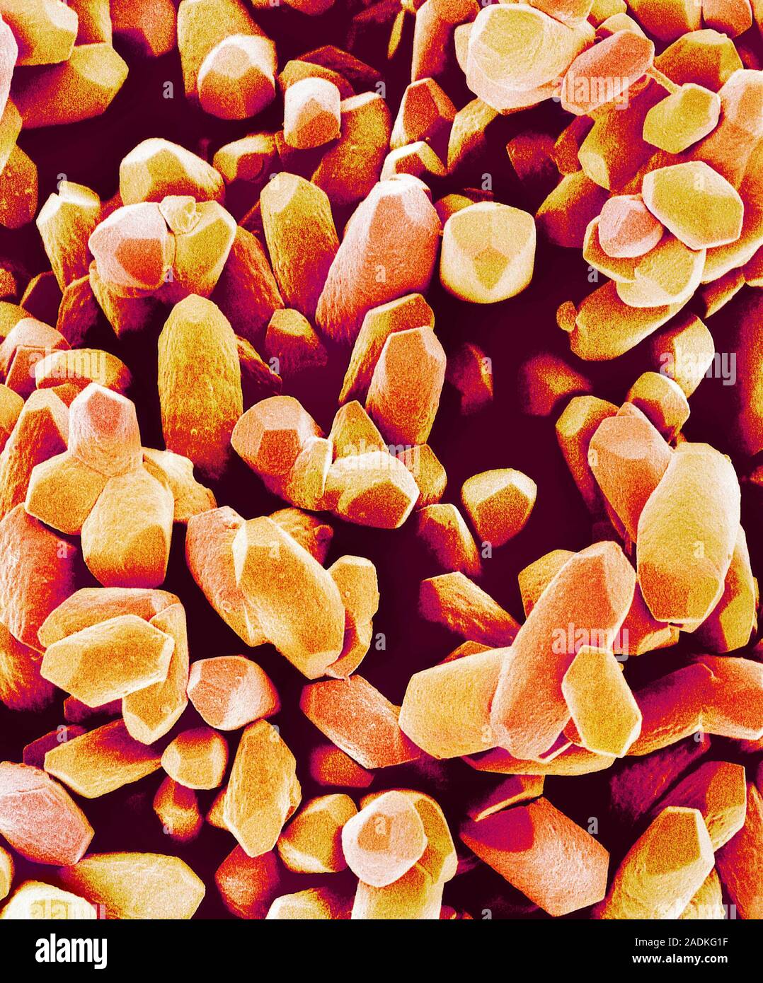 Balancing stone from inner ear. Coloured scanning electron micrograph