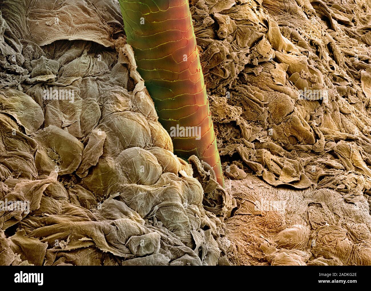 Ear canal. Coloured scanning electron micrograph (SEM) of a hair ...