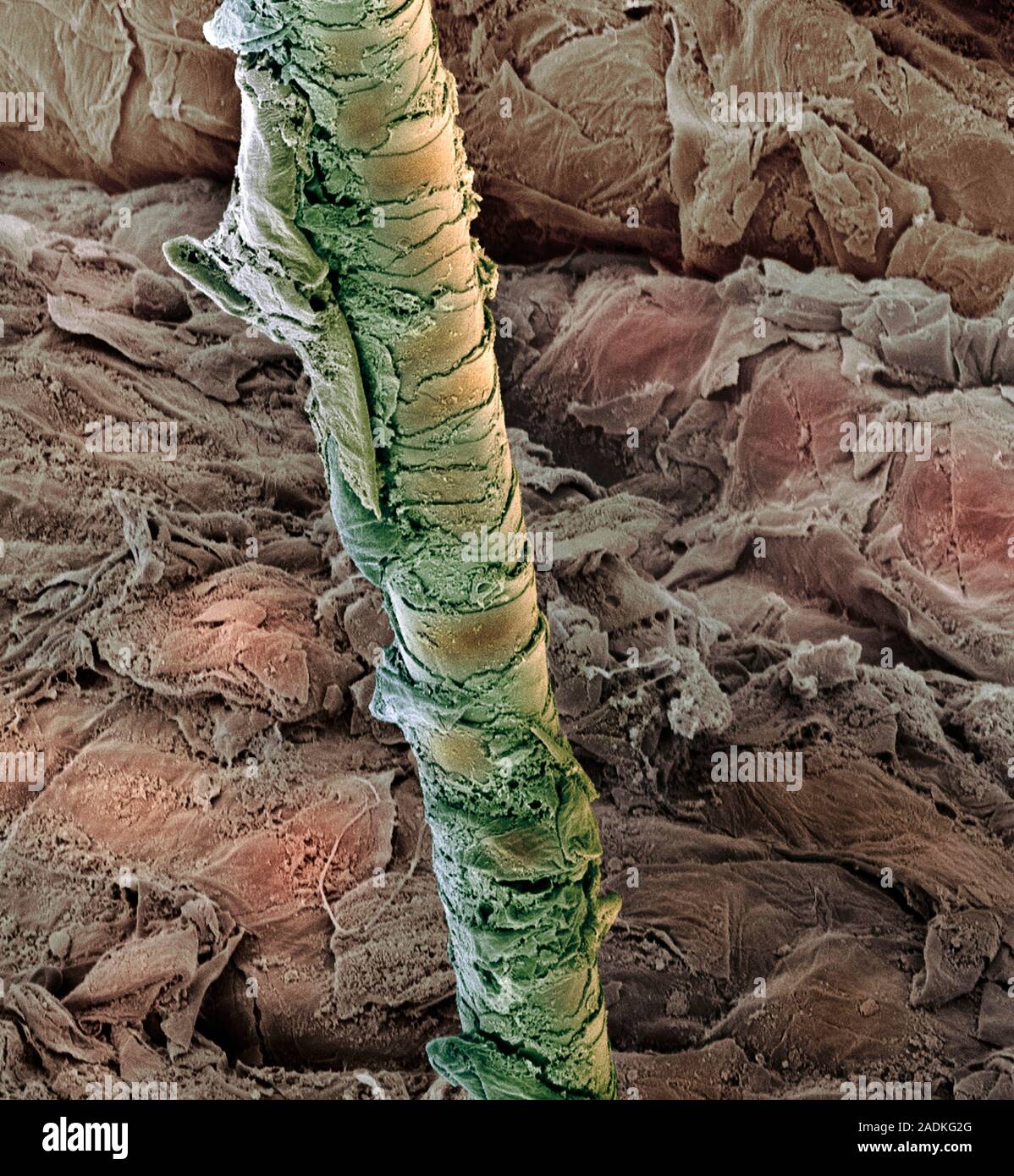Ear canal. Coloured scanning electron micrograph (SEM) of a hair (green ...