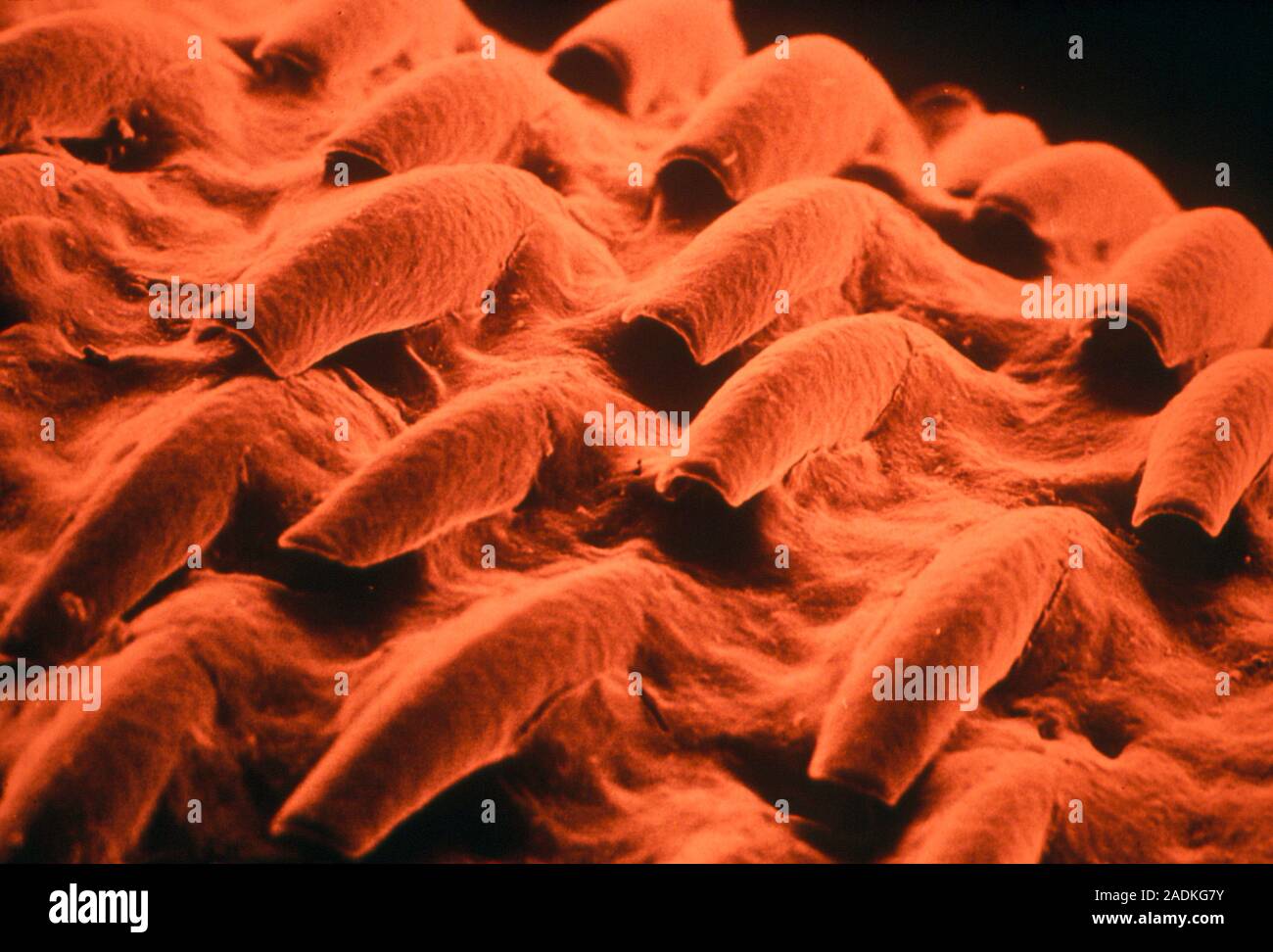 False colour scanning electron micrograph (SEM) of the upper surface of ...