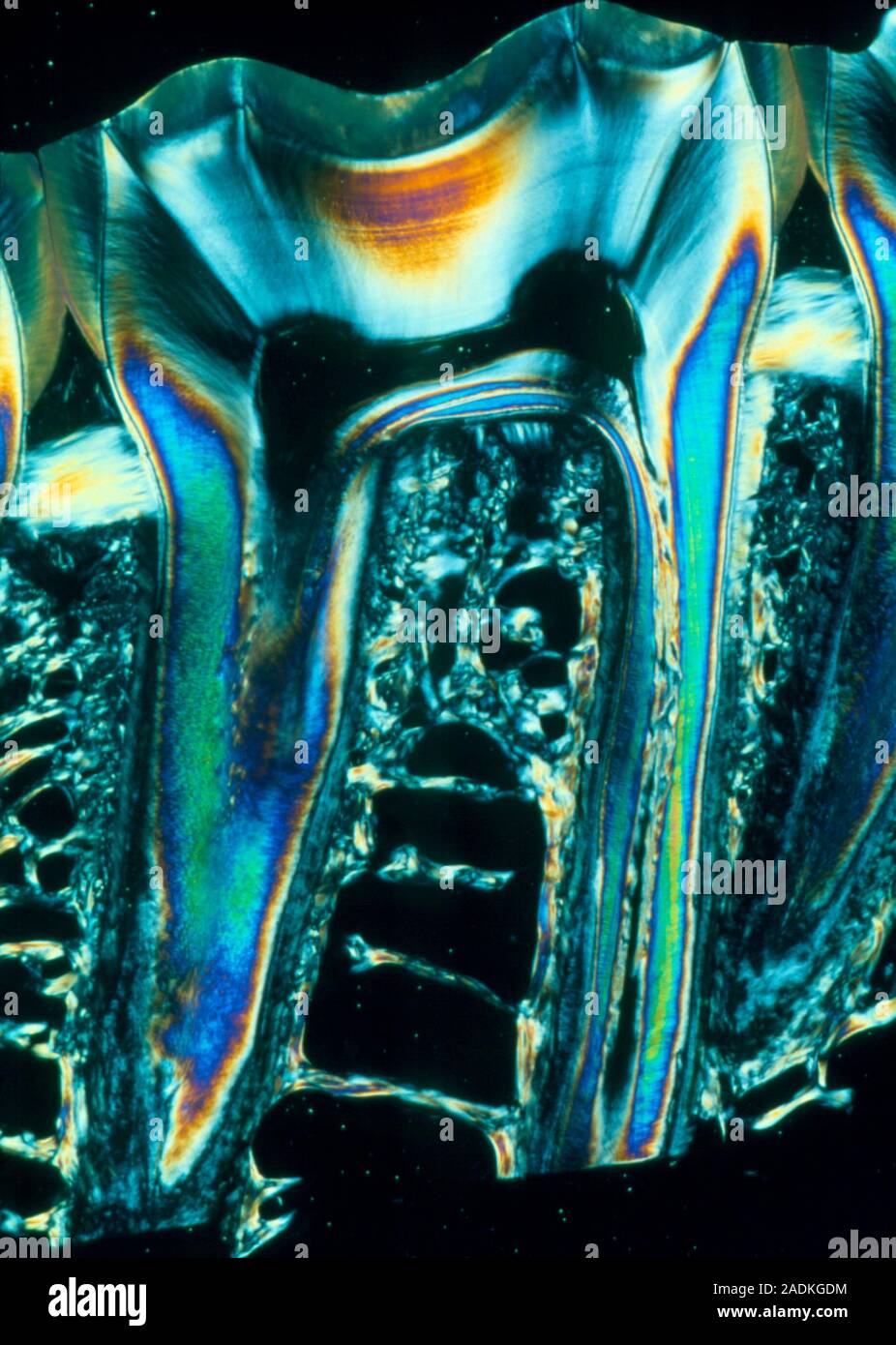 Tooth. Polarised light micrograph of a section through a molar tooth in