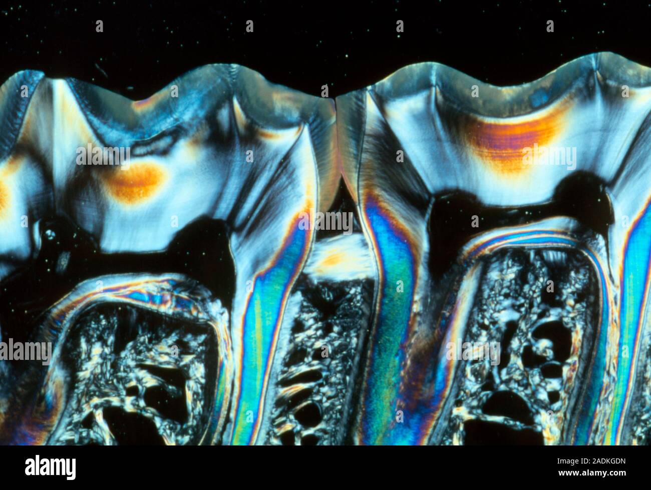 Teeth. Polarised light micrograph of a section through molar teeth in