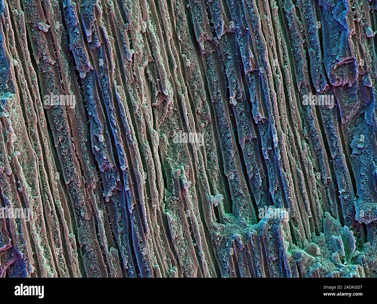 Tooth dentine. Coloured scanning electron micrograph (SEM) of dentine