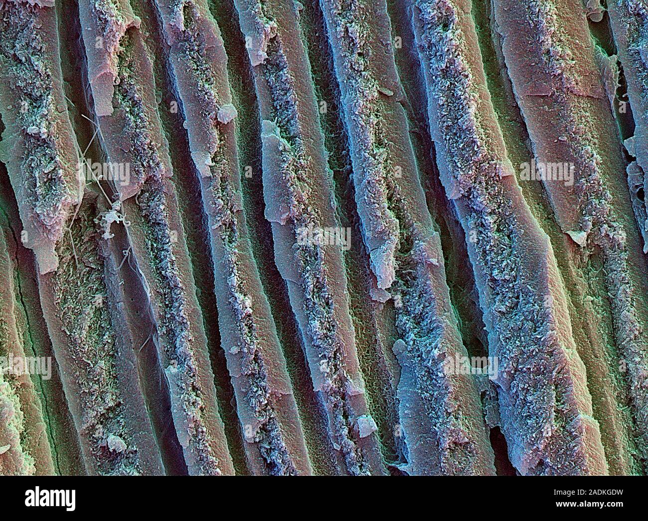Tooth dentine. Coloured scanning electron micrograph (SEM) of dentine