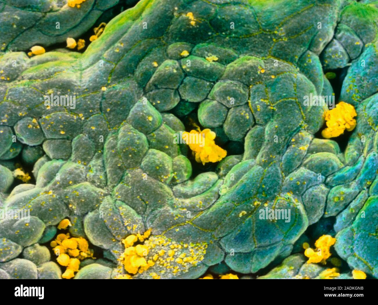 Gastric gland: false-colour scanning electron micrograph (SEM) of the ...