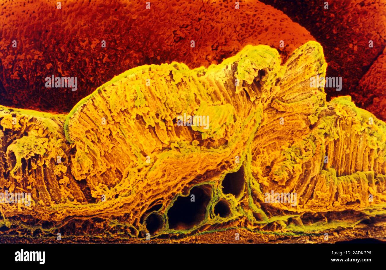 Stomach mucosa. Coloured Scanning Electron Micrograph (SEM) of a cross ...